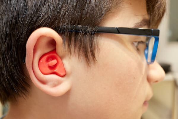 Custom earmolds